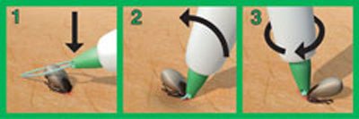 3iX Zecken - Schlinge - 3ix - Wildnissport